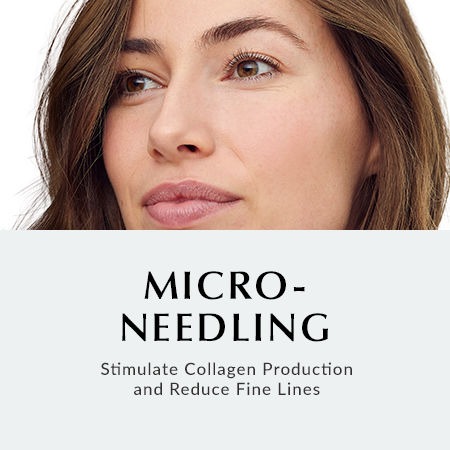 Microneedling at Thérapie Clinic